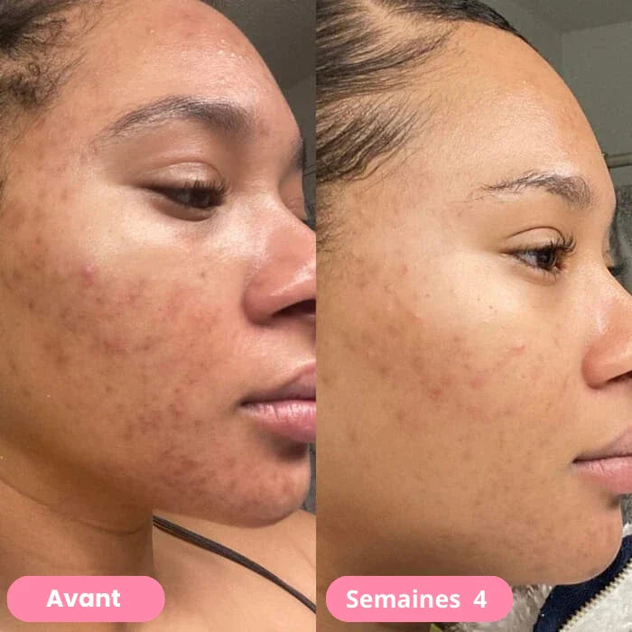 afriglow - Nettoyant pour visage